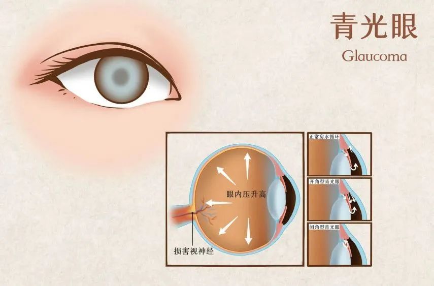 164507a3vkj7gf7jgp3j37.jpeg